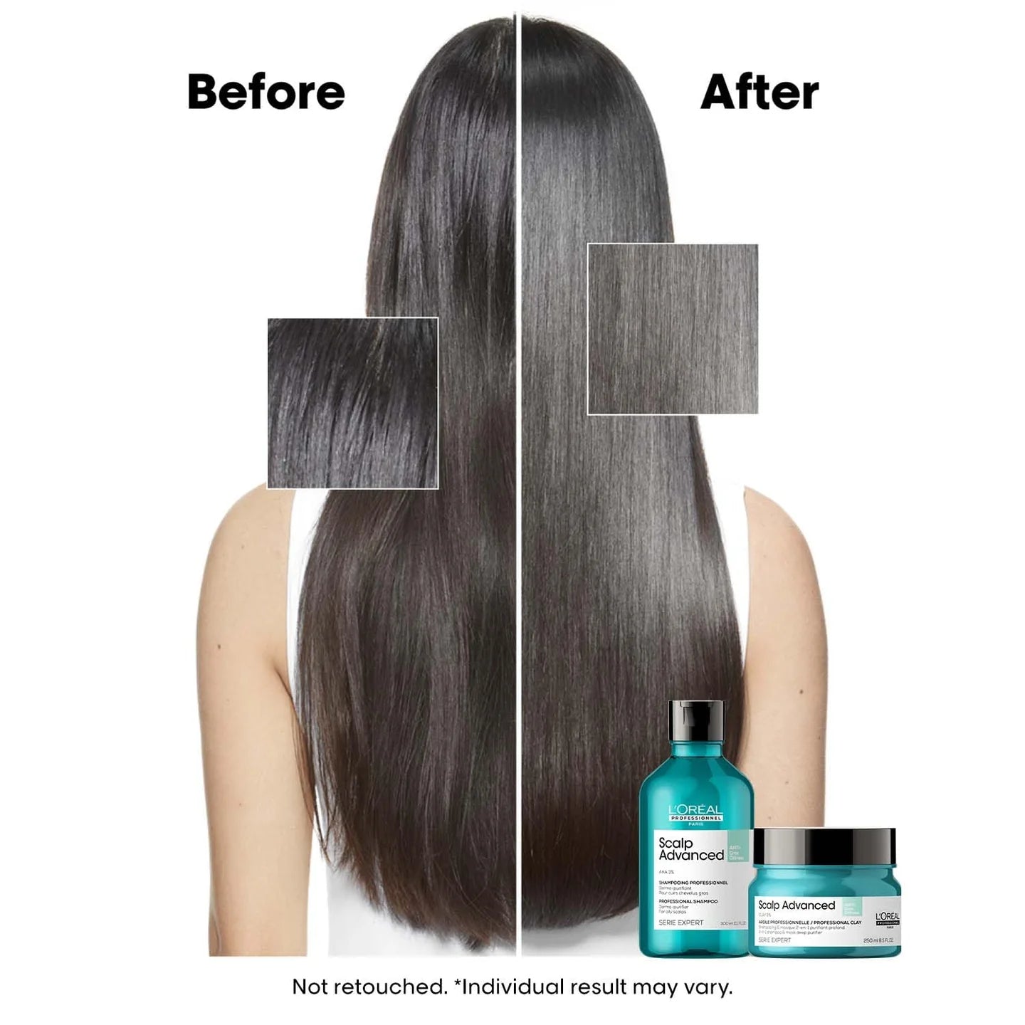 L’Oréal Professionnel Scalp Advanced Anti-Oiliness Shampoo for Oily Scalp, Less scalp sebum, 3% AHA (300ml) Click Beauty